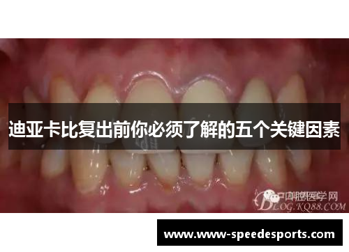 迪亚卡比复出前你必须了解的五个关键因素